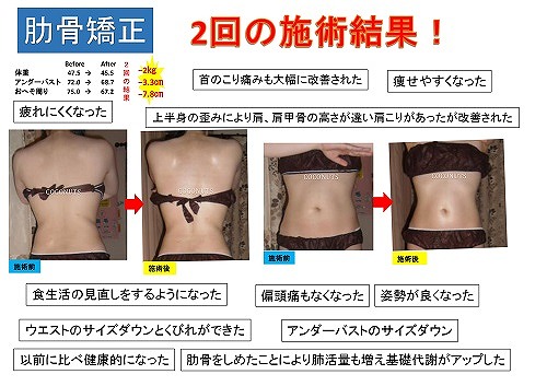 肋骨矯正】 ・姿勢が悪い方 ・肋骨の開きが気になる方 ・ダイエットしたい方 ・くびれを作りたい方 | COCONUTSブログ | 豊橋市のエステ・矯正 ・ダイエット・リラクゼーションはCOCONUTS（ココナッツ）